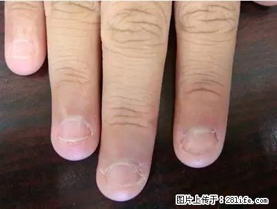 剪指甲、挖耳屎，这些日常小动作竟隐藏大危害！ - 南阳生活资讯 - 南阳28生活网 ny.28life.net